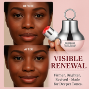 Primrose™ – Eye Renewal Massage Cream
