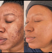 Dark Spot Brightening Cleansing Pad