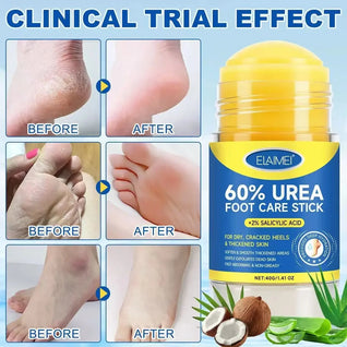 Urea Foot Care Stick  – Repairs Cracked and Dry Feet