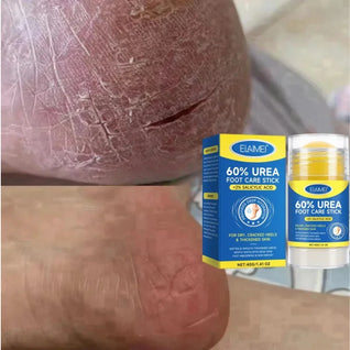 Urea Foot Care Stick  – Repairs Cracked and Dry Feet