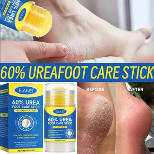 Urea Foot Care Stick  – Repairs Cracked and Dry Feet