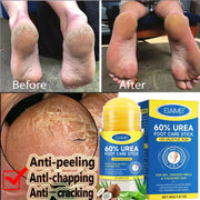 Urea Foot Care Stick  – Repairs Cracked and Dry Feet
