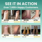 Lymphatic Support Supplements